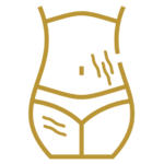 estrias
