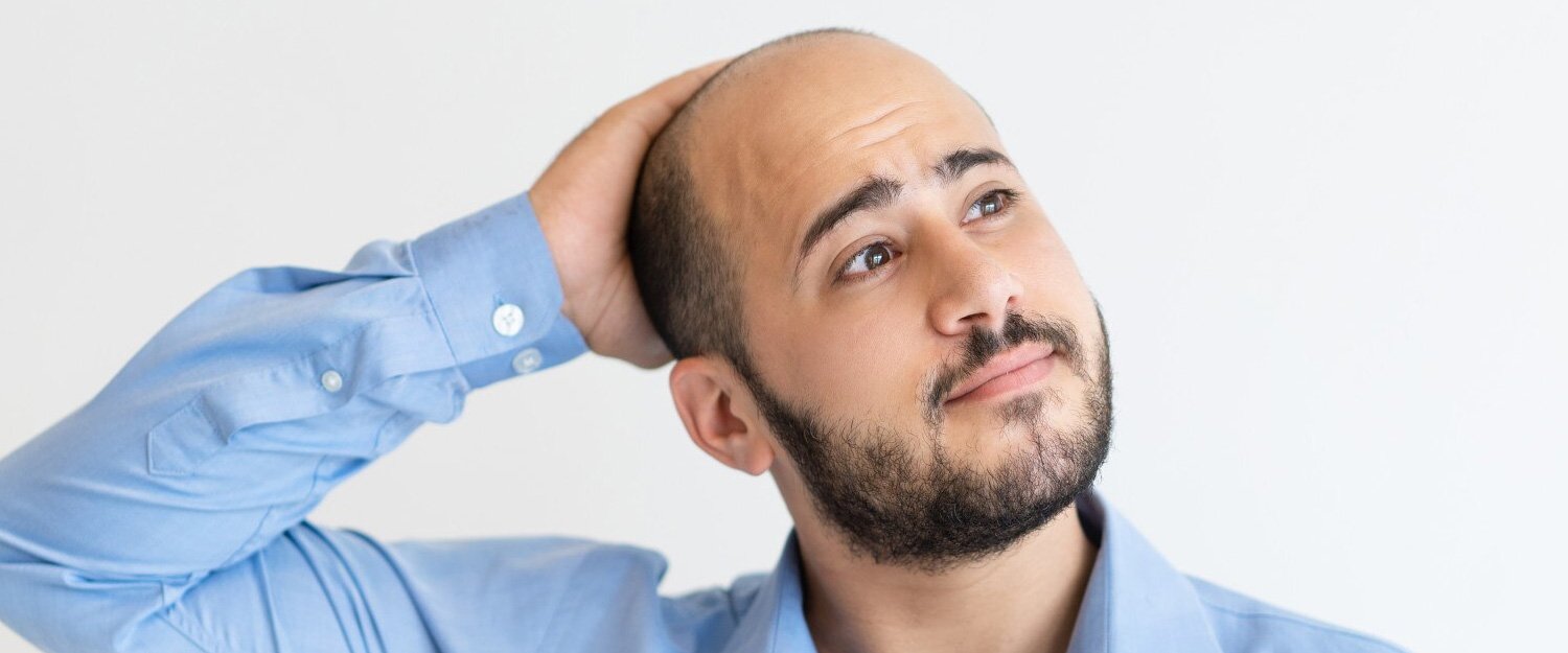 Queda de cabelo e calvície qual a diferença