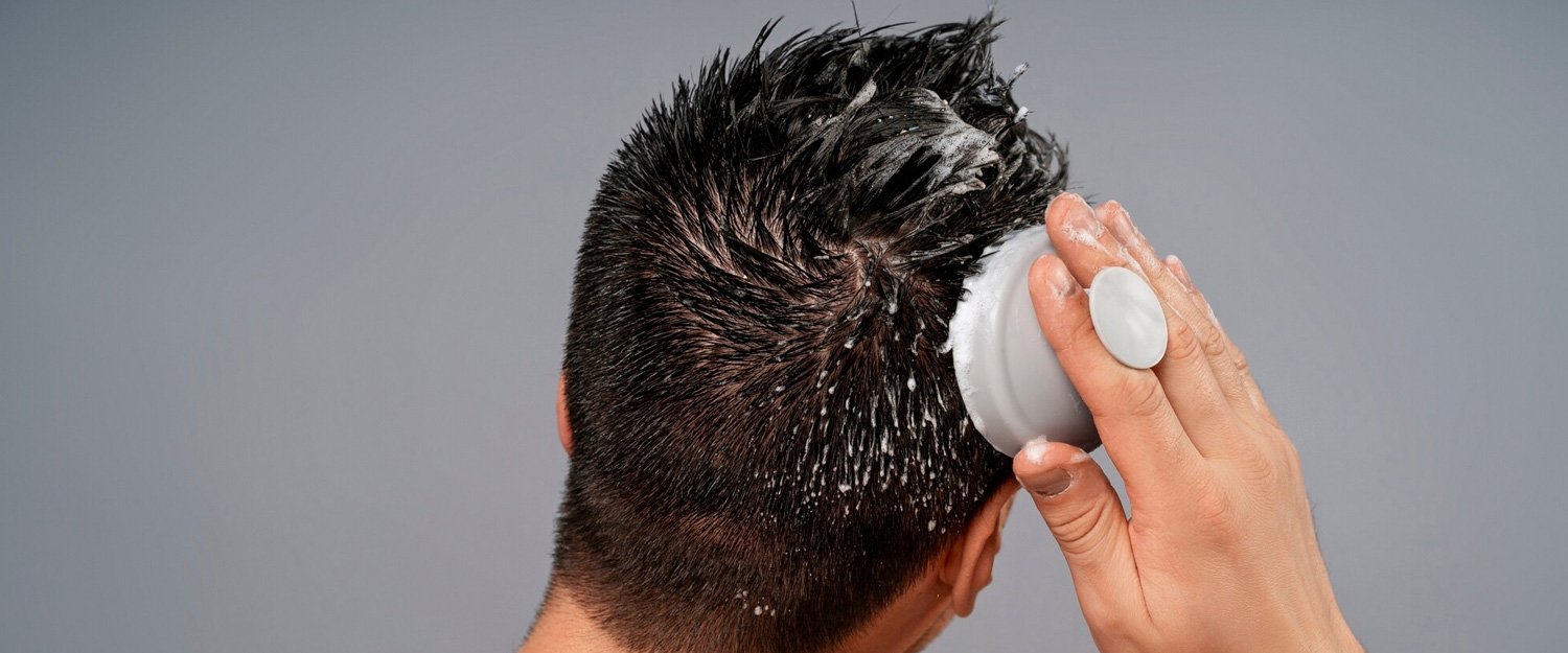 Como lavar o cabelo após o transplante capilar: cuidados importantes no pós-operatório