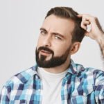 É normal os fios transplantados caírem nas primeiras semanas